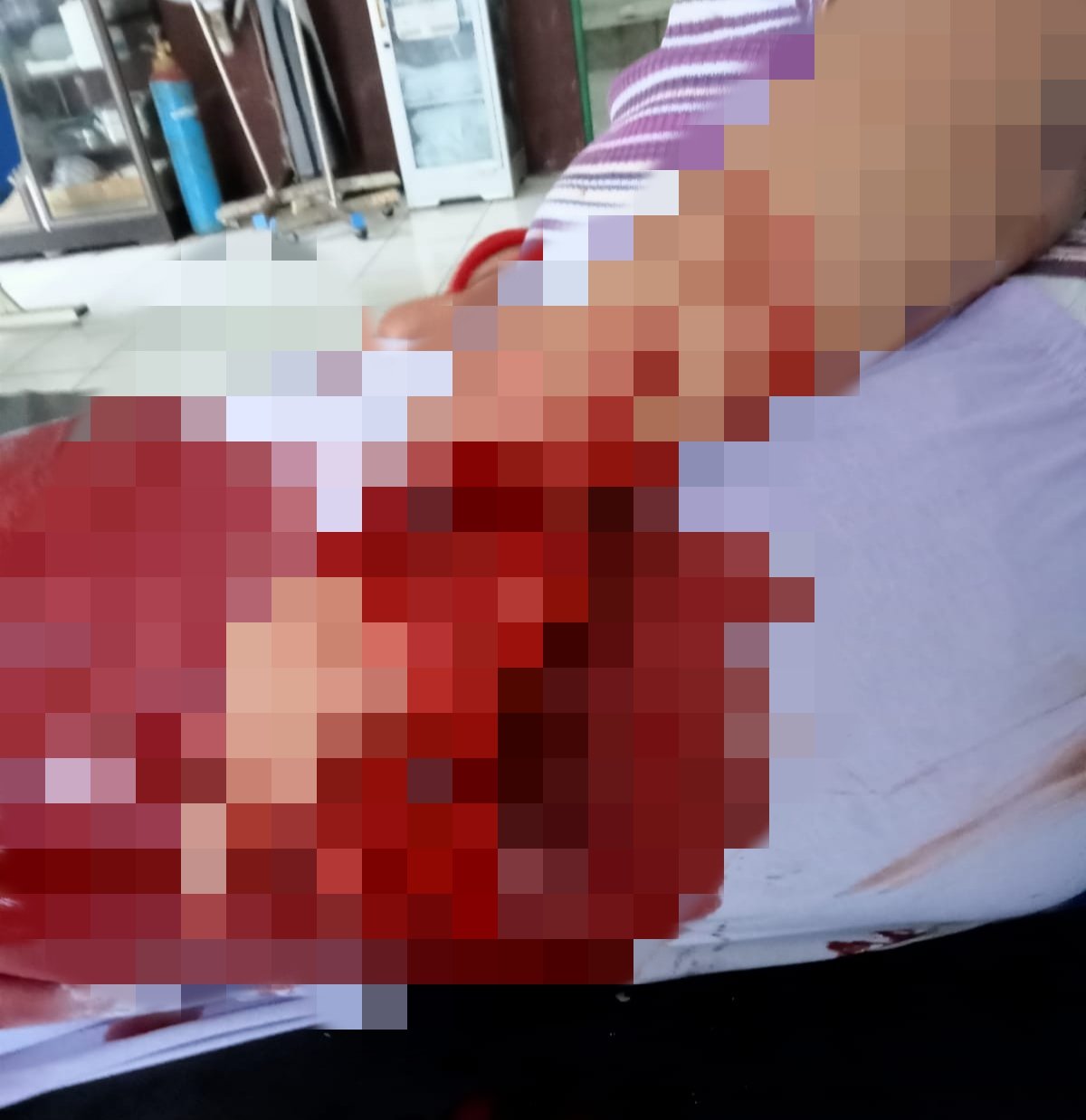 PNS Bartim ditebas adik ipar, jari tangan nyaris putus