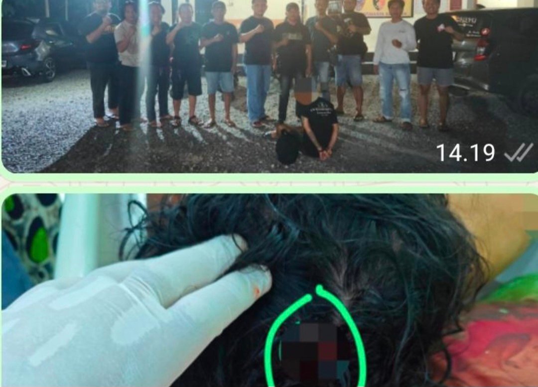 Istri Minta Cerai, Suami Gelap Mata Aniaya Korban Sampai Babak Belur